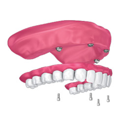 Dental Implants & Restorative Dentistry